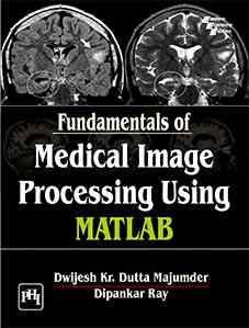 FUNDAMENTALS OF MEDICAL IMAGE PROCESSING  USING  MATLAB